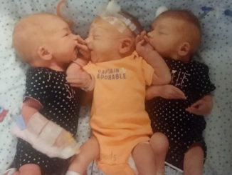 A woman in the US has had the surprise of a lifetime, after she gave birth to triplets after attending the hospital for what she thought were kidney stone pains.